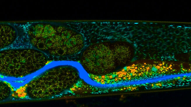 Parte do intestino de Caenorhabditis elegans ao microscópio, enriquecida com w