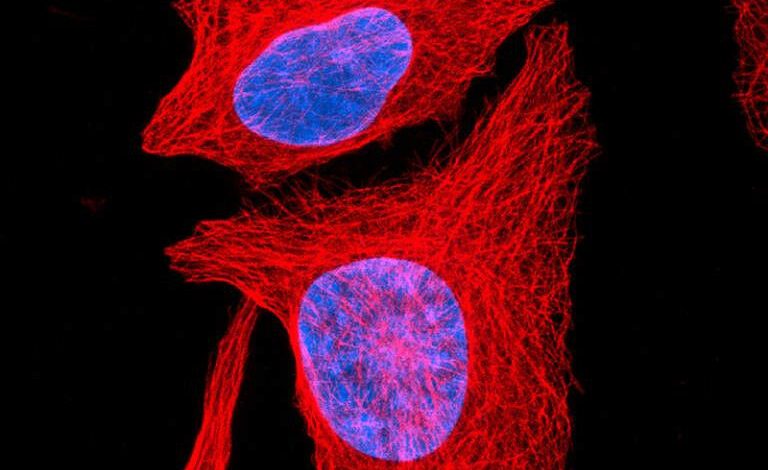 Células de osteossarcoma - Crédito: Células de osteossarcoma humano. Paul Appleton, Universidade